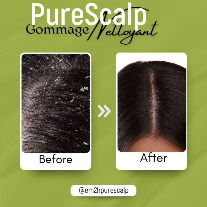 Em2h PureScalp Cleansing Scalp Scrub - Shampoing gommant cheveux